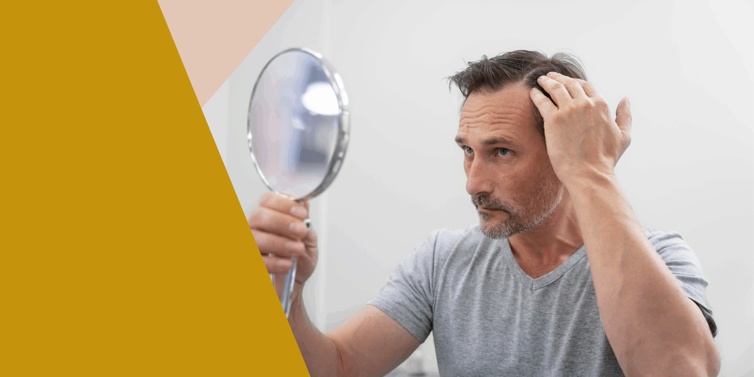 En este momento estás viendo Mesoterapia capilar en hombres: conoce este tratamiento