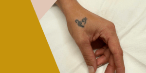 Lee más sobre el artículo Eliminación de tatuajes en Lebrija: lo último de lo último